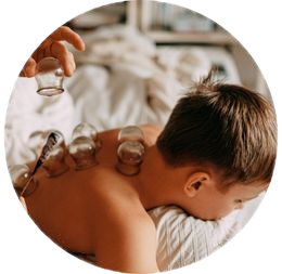cupping_transparent_cleaned cupping therapy victoria